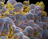 《Science》改写癌症研究:肿瘤转移并不是晚期事件